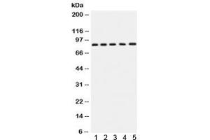 Western blot testing of 1) rat brain, 2) rat testis, 3) human SGC-7901, 4) 22RV1 and 5) MCF7 lysate with APLP1 antibody.
