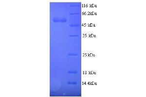 SDS-PAGE (SDS) image for Vascular Endothelial Growth Factor A (VEGFA) (AA 51-511) protein (His tag) (ABIN5713936)