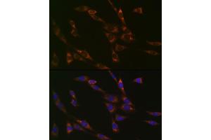 Immunofluorescence analysis of NIH-3T3 cells using RPS3 Rabbit mAb (ABIN7270025) at dilution of 1:100 (40x lens). (RPS3 anticorps)