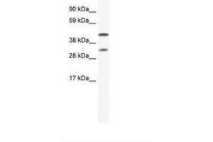 Image no. 1 for anti-Gap Junction Protein, alpha 1, 43kDa (GJA1) (AA 91-140) antibody (ABIN6736018) (Connexin 43/GJA1 anticorps  (AA 91-140))