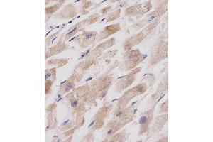 (ABIN388564 and ABIN2849716) staining GABAR in human heart tissue sections by Immunohistochemistry (IHC-P - paraformaldehyde-fixed, paraffin-embedded sections).