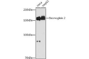 Western blot analysis of extracts of various cell lines, using Desmoglein 2 antibody (ABIN7266740) at 1:1000 dilution.
