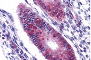 ABIN185199 (2. (DDX5 anticorps  (C-Term))