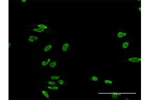 Immunofluorescence of purified MaxPab antibody to TDP1 on HeLa cell. (TDP1 anticorps  (AA 1-608))