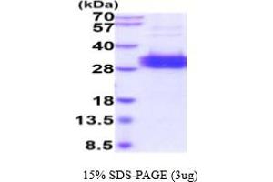 SDS-PAGE (SDS) image for Folate Receptor 1 (Adult) (FOLR1) (AA 26-234) protein (His tag) (ABIN7529354)