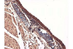 Immunohistochemistry analysis using Mouse Anti-Sodium Iodide Symporter Monoclonal Antibody, Clone 14F .