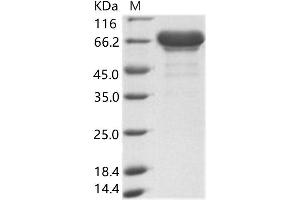 Western Blotting (WB) image for Ebola Virus Matrix protein VP40 (EBOV VP40) protein (His tag,MBP tag) (ABIN7198915) (EBOV VP40 Protein (His tag,MBP tag))