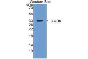 Detection of Recombinant LBP, Rat using Polyclonal Antibody to Lipopolysaccharide Binding Protein (LBP) (LBP anticorps  (AA 226-480))