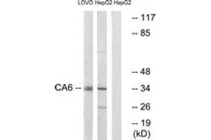 Western Blotting (WB) image for anti-Carbonic Anhydrase VI (CA6) (AA 231-280) antibody (ABIN2890191) (CA6 anticorps  (AA 231-280))