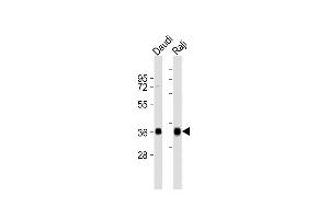 All lanes : Anti-HLA-DQA1 Antibody (C-term) at 1:8000 dilution Lane 1: Daudi whole cell lysates Lane 2: Raji whole cell lysates Lysates/proteins at 20 μg per lane.