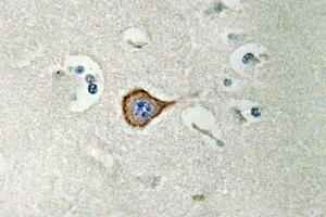 Immunohistochemistry (IHC) analyzes of CNPase antibody in paraffin-embedded human brain tissue. (Cnpase anticorps)