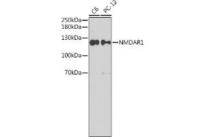 Western blot analysis of extracts of various cell lines, using NMD antibody (ABIN6133732, ABIN6141399, ABIN6141402 and ABIN7101806). (GRIN1/NMDAR1 anticorps  (AA 600-700))