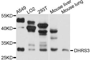 Western blot analysis of extracts of A375 cell line, using DHRS3 antibody. (DHRS3 anticorps)