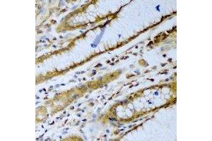 Immunohistochemical analysis of beta-TrCP staining in human stomach formalin fixed paraffin embedded tissue section. (beta-TrCP anticorps)