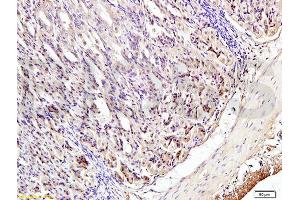 Formalin-fixed and paraffin embedded mouse stomach tissue labeled with Anti-Phospho-IRF3 (Ser396) Polyclonal Antibody, Unconjugated (ABIN742688) at 1:200 followed by conjugation to the secondary antibody and DAB staining