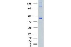 Validation with Western Blot