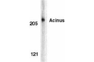 Western blot analysis of acinus in K562 whole cell lysate with AP30013PU-N Acinus antibody at 1 μg/ml. (ACIN1 anticorps)