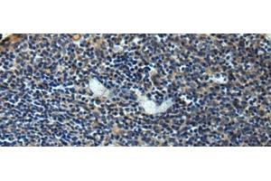 Immunohistochemistry of paraffin-embedded Human tonsil tissue using ERLIN1 Polyclonal Antibody at dilution of 1:50(x200) (ERLIN1 anticorps)