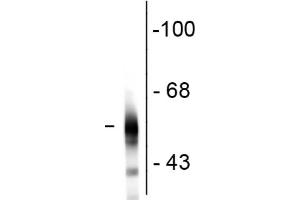 Western Blot - Mouse Anti-Tubulin B III antibody Western Blot of Mouse Anti-Tubulin ß III antibody. (TUBB3 anticorps)