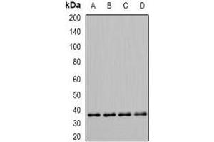 Western blot analysis of PDHB expression in Hela (A), Jurkat (B), mouse skeletal muscle (C), rat heart (D) whole cell lysates. (PDHB anticorps)