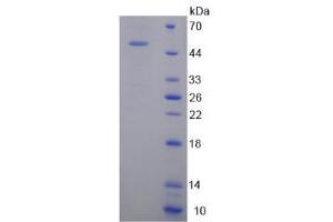 SDS-PAGE analysis of Tenascin C Protein. (TNC Protéine)