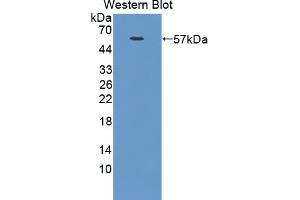 Figure. (NUAK1 anticorps  (AA 404-651))