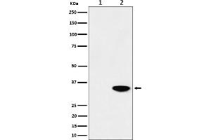 Western blot analysis of Phospho-Nucleophosmin (T199) expression in (1) HeLa cell lysate, (2) HeLa cell treated with CA lysate.