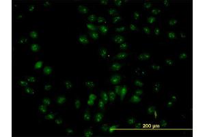 Immunofluorescence of purified MaxPab antibody to NOP56 on HeLa cell.