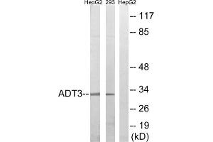 Western blot analysis of extracts from HepG2 cells and 293 cells, using SLC25A6 antibody. (SLC25A6 anticorps  (Internal Region))