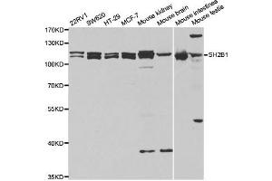 Western Blotting (WB) image for anti-SH2B Adaptor Protein 1 (SH2B1) antibody (ABIN1876744) (SH2B1 anticorps)