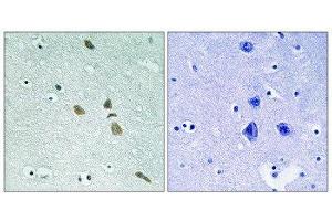 Immunohistochemistry (IHC) image for anti-Integrin-Linked Kinase (ILK) (Ser246) antibody (ABIN1848218)