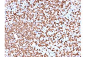 Formalin-fixed, paraffin-embedded human Spleen stained with CD74 Mouse Monoclonal Antibody (LN-2). (CD74 anticorps)