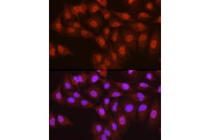 Immunofluorescence analysis of A-549 cells using ASC/TMS1 Rabbit pAb (ABIN3021616, ABIN3021617, ABIN3021618, ABIN1513454 and ABIN6215392) at dilution of 1:250 (40x lens).