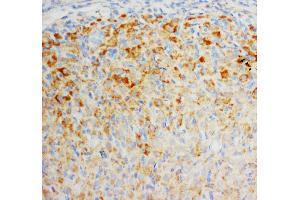 Anti-FGF8 antibody, IHC(P) IHC(P): Rat Ovary Tissue (FGF8 anticorps  (C-Term))