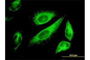 Immunofluorescence of monoclonal antibody to KRT18 on HeLa cell.