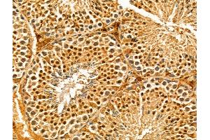 ABIN7094313 and ABIN7098360 at 1/100 staining Mouse testis tissue by IHC-P. (IWS1 anticorps  (N-Term))