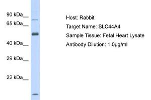 Host: Rabbit Target Name: SLC44A4 Sample Tissue: Human Fetal Heart Antibody Dilution: 1ug/ml (SLC44A4 anticorps  (Middle Region))