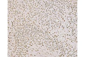 IHC analysis of SND1 using anti-SND1 antibody (ABIN7600525). (SND1 anticorps  (AA 20-204))