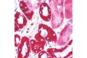 Immunohistochemical analysis of Aquaporin 2 staining in human kidney formalin fixed paraffin embedded tissue section.