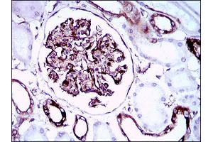 Immunohistochemical analysis of paraffin-embedded kidney tissues using SYCP3 mouse mAb with DAB staining. (SYCP3 anticorps  (AA 27-128))