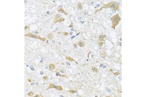 Immunohistochemistry of paraffin-embedded rat brain using APOL1 antibody at dilution of 1:100 (40x lens). (APOL1 anticorps)