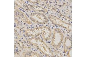 Immunohistochemistry of paraffin-embedded human kidney using BCL2L1 antibody at dilution of 1:200 (x400 lens) (BCL2L1 anticorps  (AA 1-120))