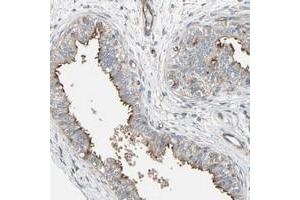 Immunohistochemical staining of human epididymis with FAM12B polyclonal antibody  shows membranous positivity in glandular cells at 1:50-1:200 dilution. (EDDM3B anticorps)