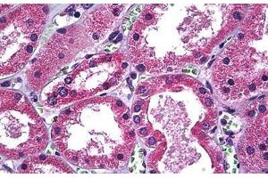 Human Kidney: Formalin-Fixed, Paraffin-Embedded (FFPE)