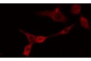 ABIN6275565 staining RAW264. (SHANK2 anticorps  (Internal Region))