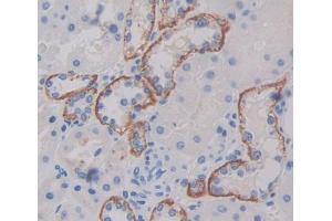 IHC-P analysis of kidney tissue, with DAB staining. (TAP1 anticorps  (AA 525-808))