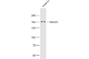 Mouse cerebrum lysates probed with MAGI3 Polyclonal Antibody, Unconjugated  at 1:300 dilution and 4˚C overnight incubation.