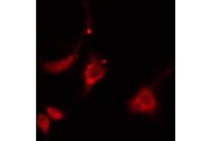 ABIN6274873 staining HepG2 cells by IF/ICC. (ATP5H anticorps  (C-Term))