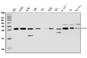 Western blot analysis of RanBP1 using anti-RanBP1 antibody (ABIN5518868).
