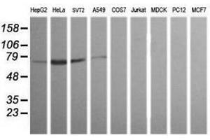 Image no. 1 for anti-ERG, ETS transcription factor (ERG) antibody (ABIN1498080) (ERG anticorps)